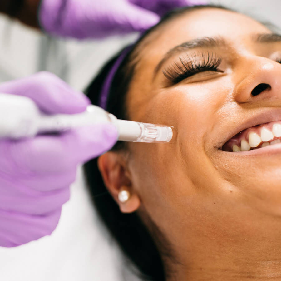 Aesthetic nurse performs microneedling on a client's face.