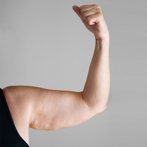 Woman demonstrates her bingo arms.