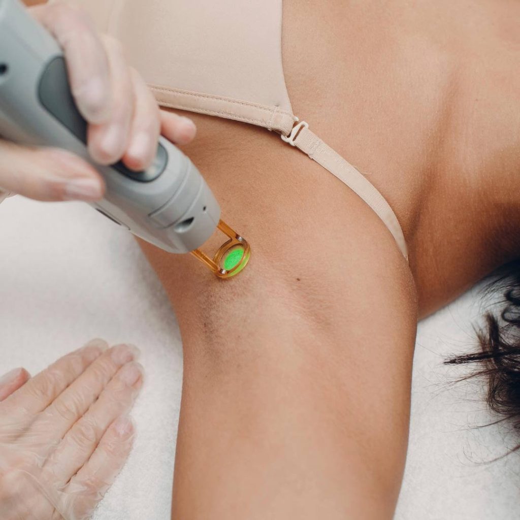 Laser technician performs laser hair removal on client's armpits.