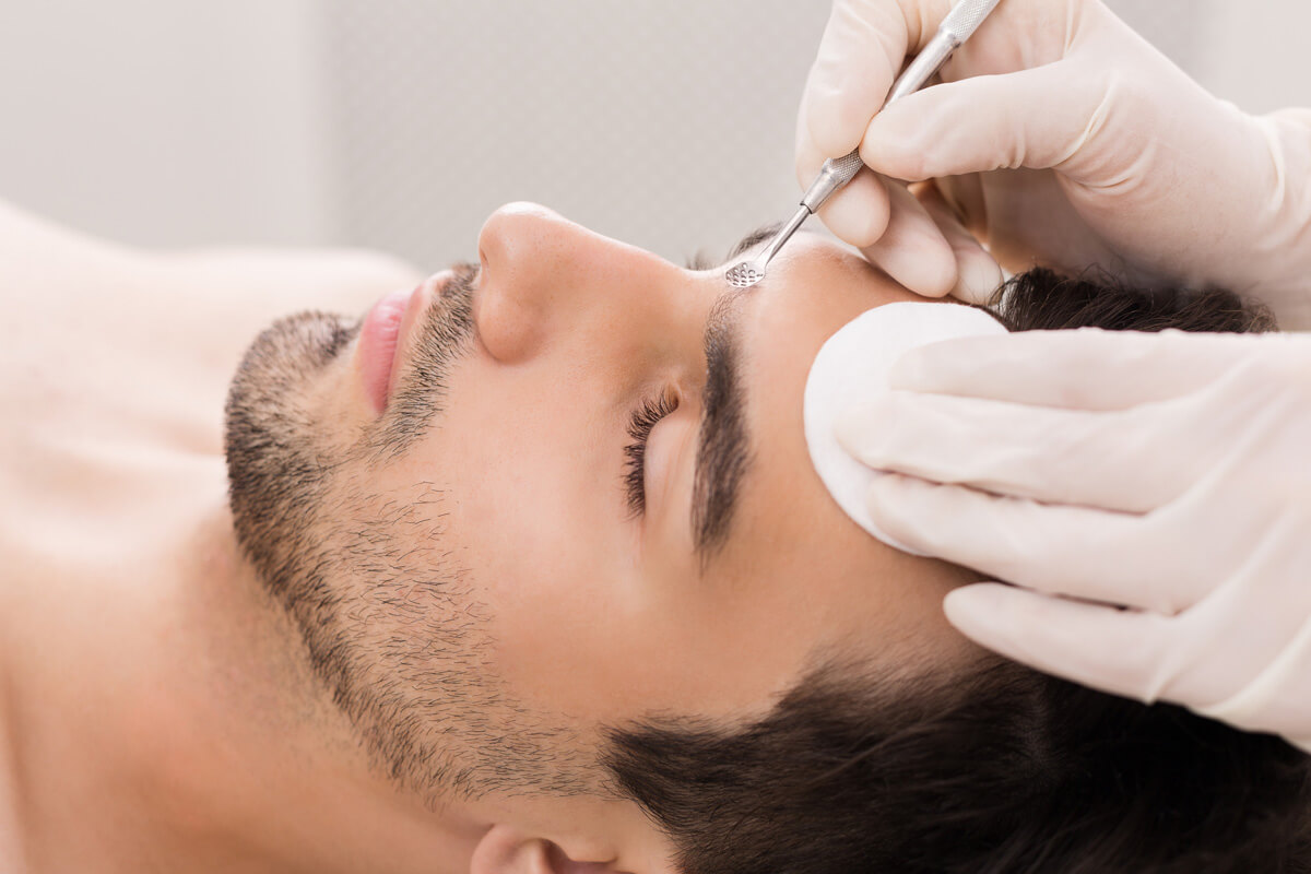 Aesthetician performs extractions on a man's face.